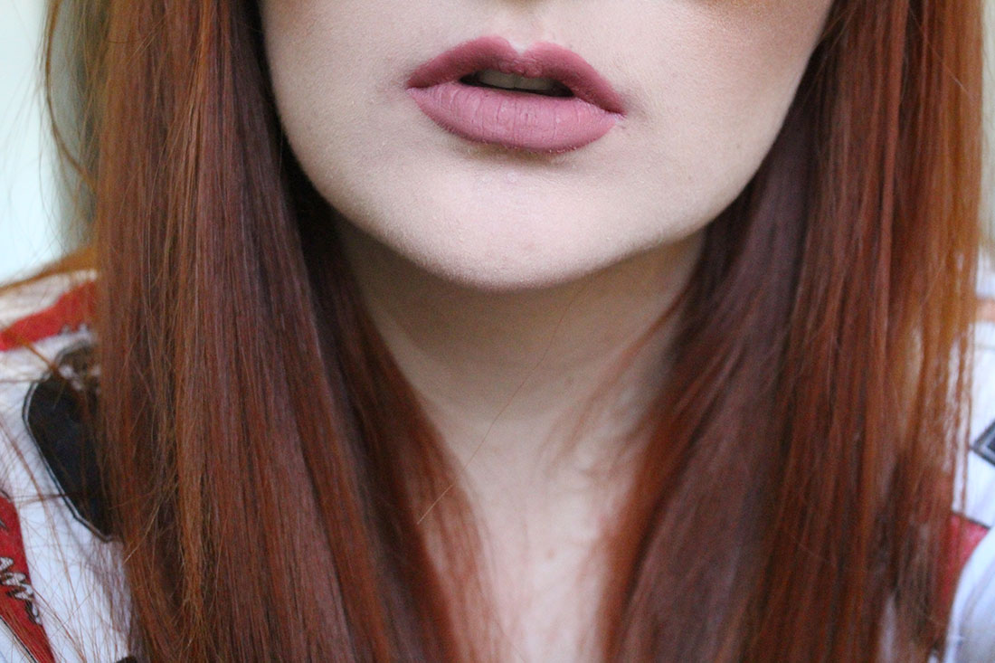 {PhotoAlt}