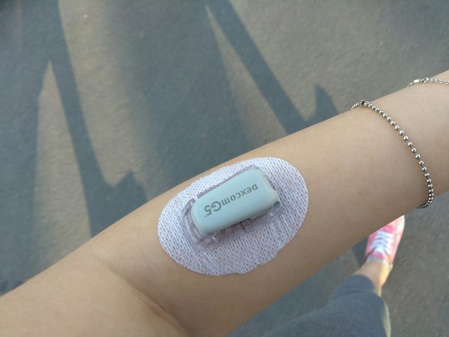 living with type 1 diabetes living with type 1 diabetes